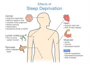 Sleep apnea health risks.